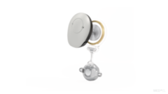 Datei:Bonebridge System Samba 2.png