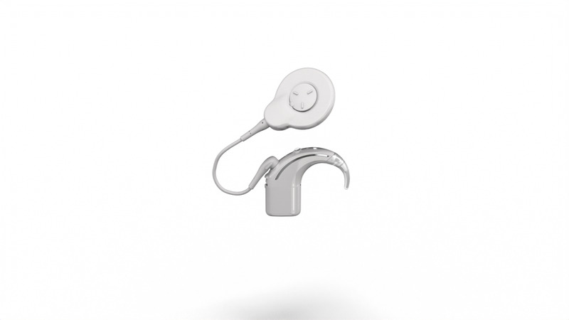 Datei:Cochlear-N8-Nexa-SP-ANI.jpg