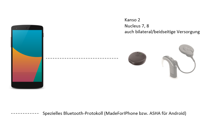 Datei:Cochlear Mobiltelefon direkt.png