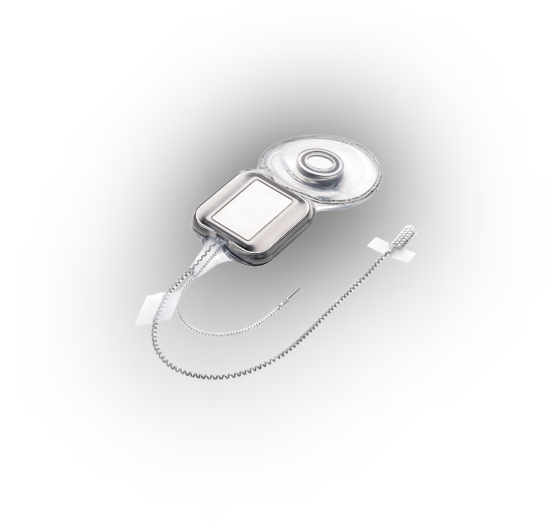 Datei:Cochlear Profile ABI541.png