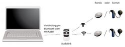 Schematische Darstellung einer technischen Anbindung für eine Videokonferenz bei bilateraler Versorgung mit CI's von MED-EL. Der Audiolink ist entweder per Bluetooth oder mit dem Kabel mit dem Laptop verbunden. Die Prozessoren (Rondo oder Sonnet) sind per Funk mit dem Audiolink gekoppelt.
